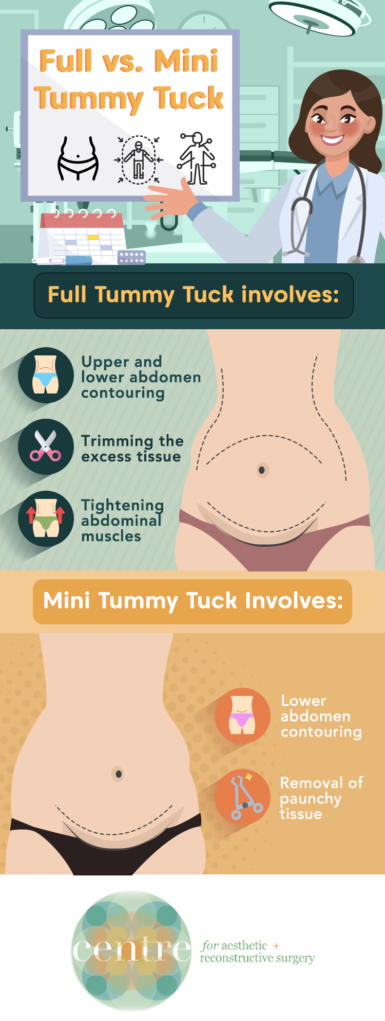 Fully Abdominoplasty vs. Mini Tummy Tuck