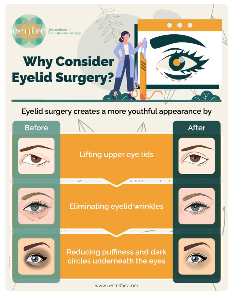 Why consider eyelid surgery 808x1024 2