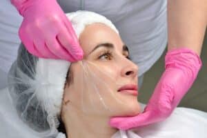 Images shows depicts where a doctor can put threads on a female patient to subtly lift the skin and tissue for a younger appearance